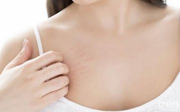 Хөхний хорт хавдрын 1, 2-р үе шатанд зовуурь илэрдэггүй нь хожуу үе шатандаа оношлогдох шалтгаан болдог 