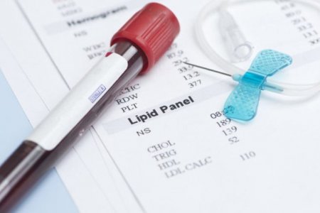 Англи иргэний хариу СӨРӨГ гарчээ