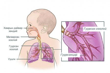  2019 онд уушгины хатгалгаа өвчнөөр 78141 хүн эмнэлэгт хэвтэж, 431 хүн нас баржээ