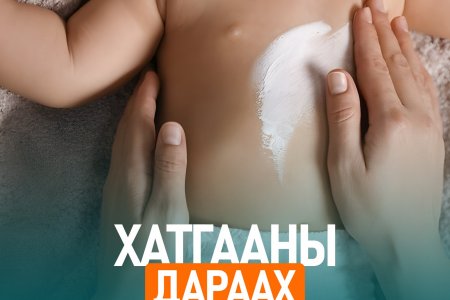 Уушгины хатгаа туссаны дараа юунд анхаарах вэ?