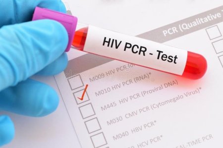 Ковид-19!!! PCR ШИНЖИЛГЭЭ Д.Мандахнаран, АУ-ны доктор