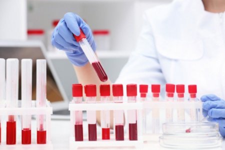 Иргэдийг 60-150 мянган төгрөгийн багц шинжилгээнд хамруулна