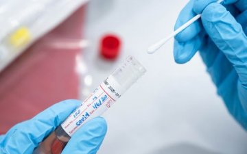 PCR шинжилгээний сорьц авах үед хамар, салстыг гэмтээхгүй гэв