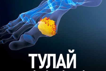 Тулай өвчний тухай хүмүүсийн мэддэггүй баримтууд