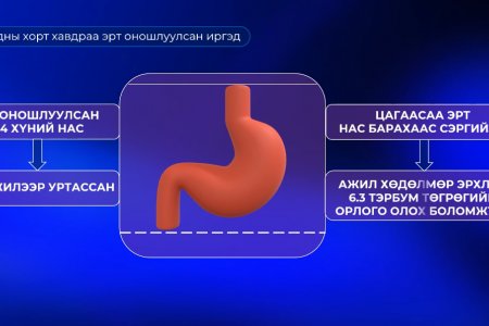 Эрт илрүүлэгт хамрагдсан нийт иргэдийн 50 орчим хувь нь хоол боловсруулах эрхтэн тогтолцооны  өвчлөлтэй гарчээ