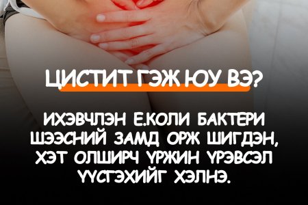 Цистит гэж юу вэ?
