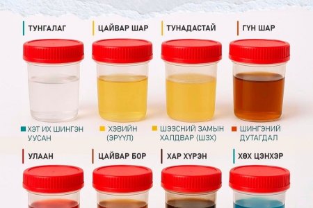 ​​​​​​​Шээсний өнгө бидэнд юуг хэлдэг вэ? 