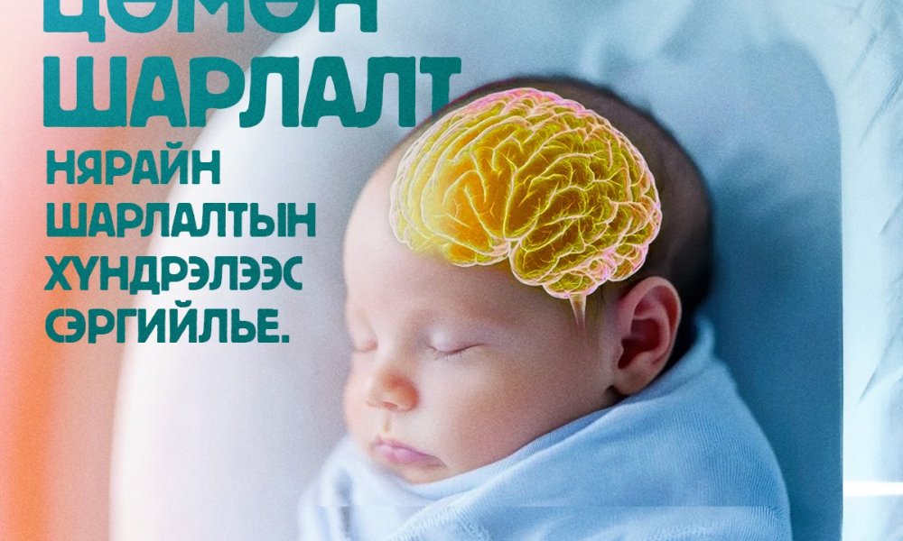 Нярайн шарлалт хүндэрвэл аюултай.