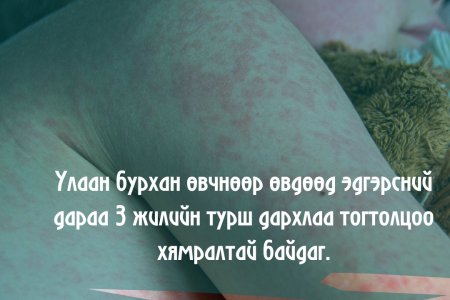 Улаанбурханы халдвар аюултай биш үү? үгүй юу? 