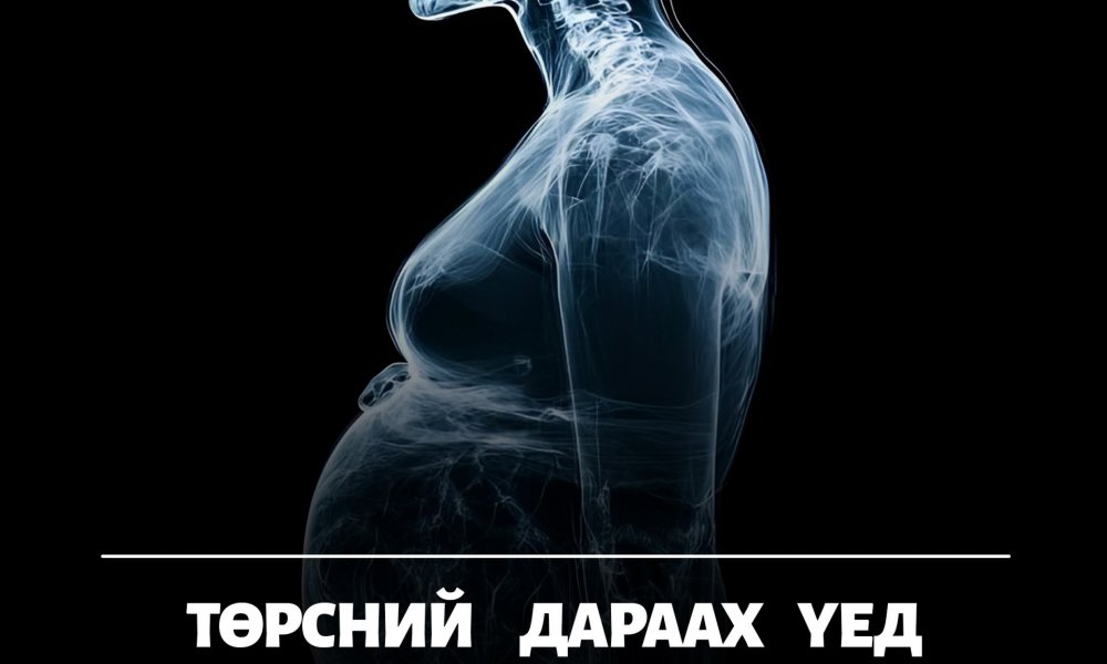 Төрсний дараа амархан мартаад байна уу?