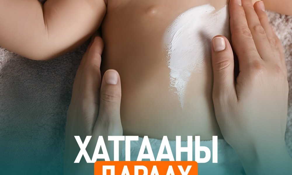 Уушгины хатгаа туссаны дараа юунд анхаарах вэ?