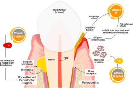 Витамин Д-н дутагдал шүдэнд нөлөөлдөг үү?