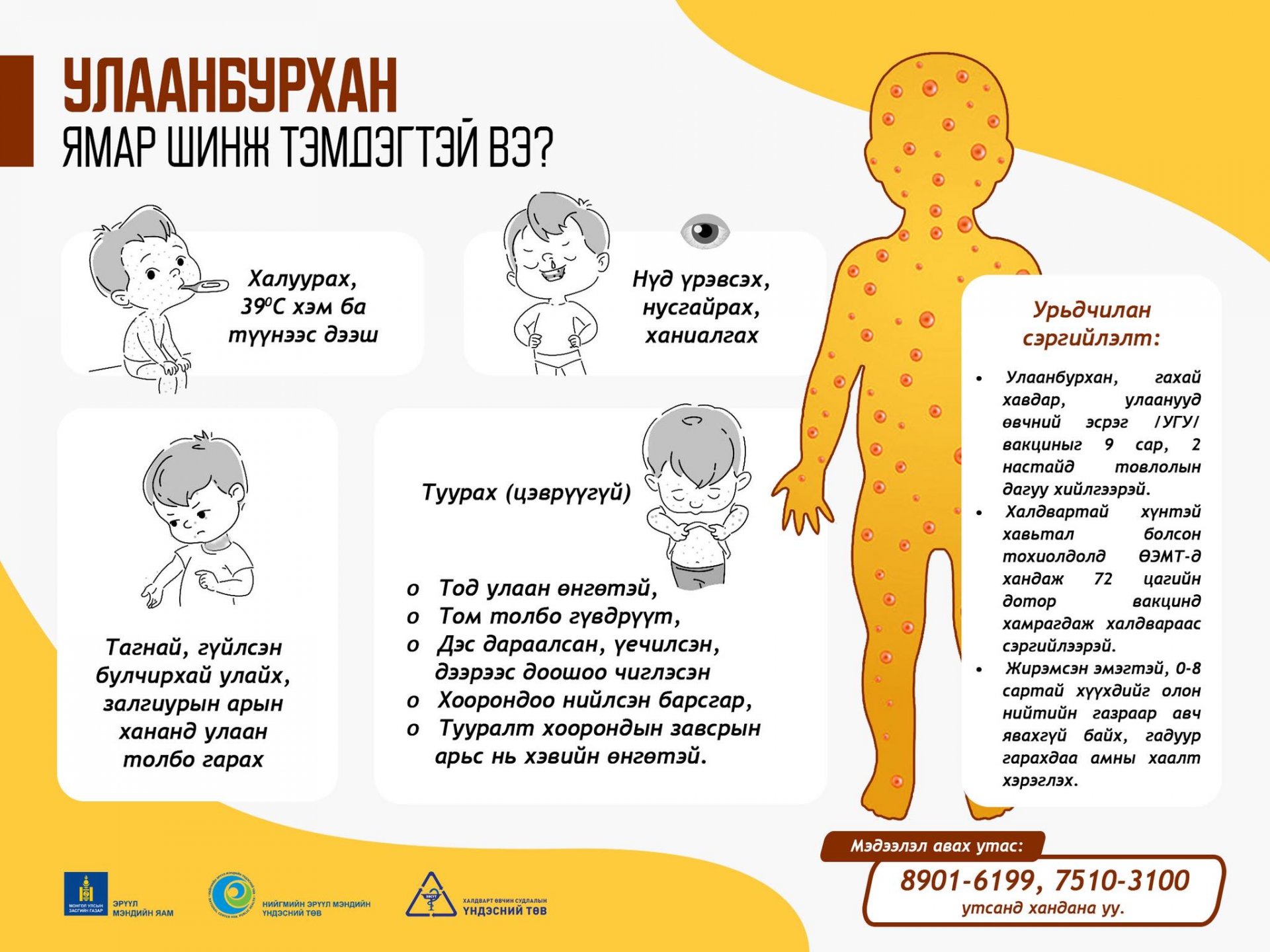 УЛААНБУРХАН ӨВЧНӨӨС  ХАМТДАА СЭРГИЙЛЬЕ.