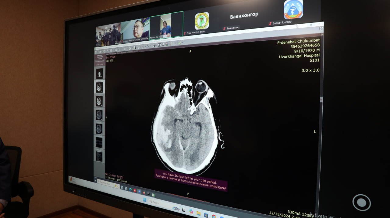 Иргэд орон нутагтаа рентген, СТ, MRI, МАМОГРАФИК дүрс оношилгоог хийлгэх боломжтой боллоо.