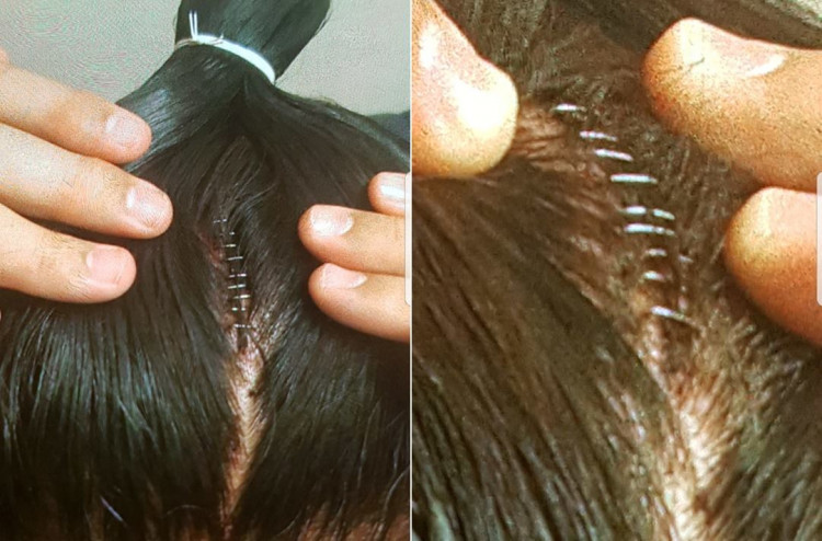 Таканоивагийн ах дүүгийнхээ толгойд тавиулсан оёдлын зургийг дэлгэлээ