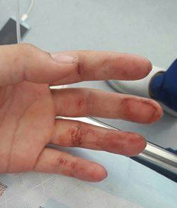 Эхнэр маань гараа урагдтал төрхийн сандал дээр тэмцэж, эцэст нь үрээ алдлаа