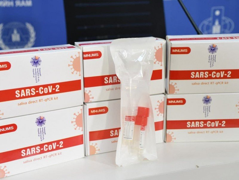 Шүлснээс коронавирус илрүүлэх PCR шинжилгээний 10 мянган оношлуурыг ЭМЯ-нд хүлээлгэн өглөө