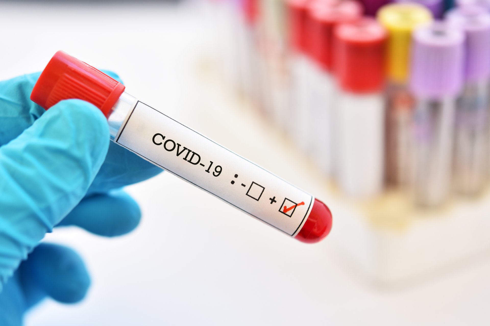 Д.Нямхүү: ОХУ-аас ирсэн 13 хүнээс коронавирусийн халдвар илэрч, батлагдсан тохиолдол 161 боллоо