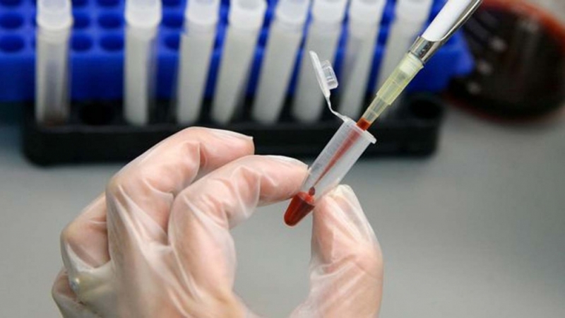 ДОХ-ын 252 тохиолдол бүртгэгджээ