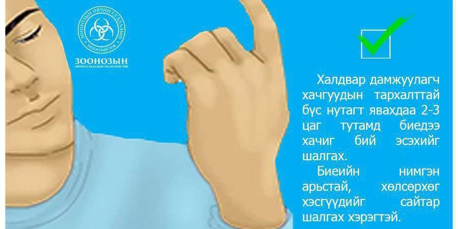 Хачиг хэдий жижиг ч нэг л хазалтаар аюулт өвчнийг дамжуулдаг