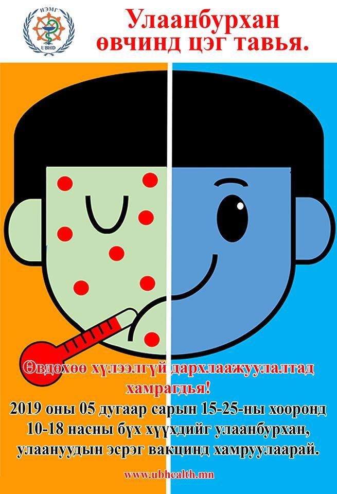Улаанбурхан, улаанууд өвчний эсрэг нэмэлт дархлаажуулалт өнөөдөр эхэлж байна