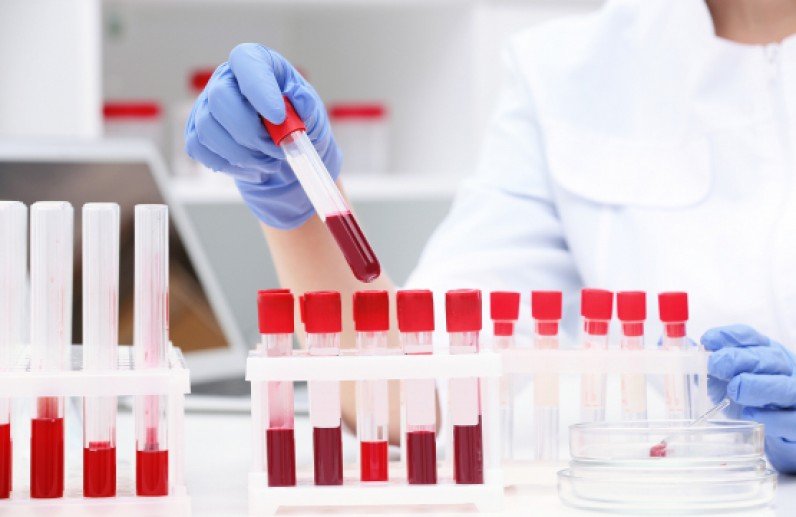 Иргэдийг 60-150 мянган төгрөгийн багц шинжилгээнд хамруулна