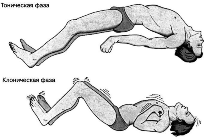 Хөнгөлөлттэй эмийн жагсаалтаас зарим нэр төрлийн эм хасагдсан нь иргэдэд хүндрэлтэй байна