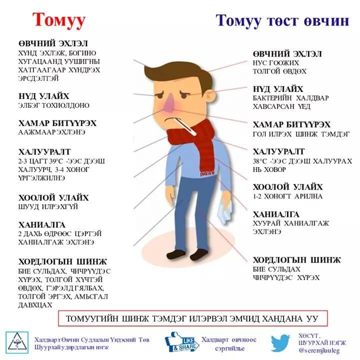 Томуу төст өвчин улсын хэмжээний дэгдэлтийн түвшинд хүрчээ