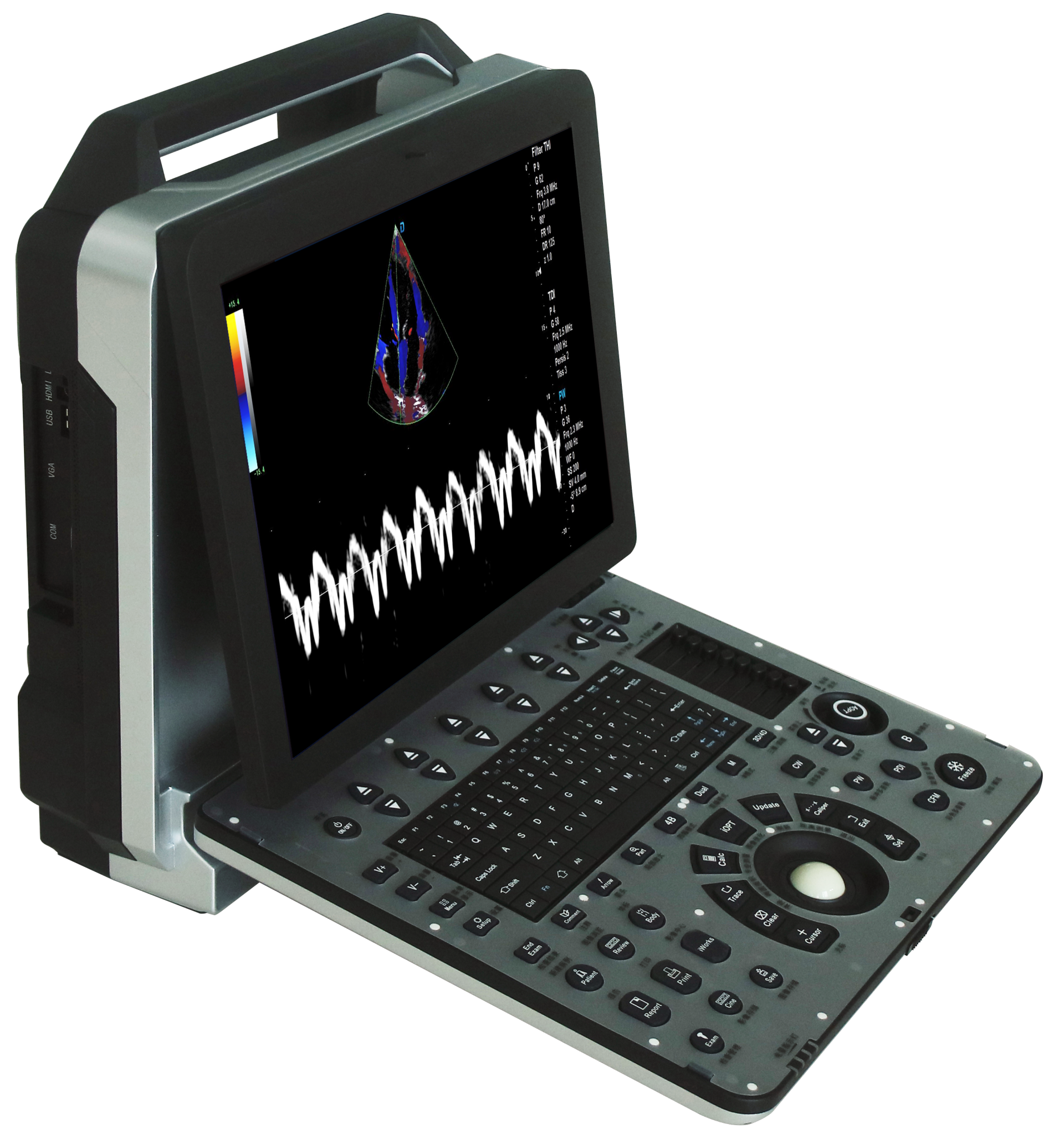 DW-P8 echo & 4D portable color doppler ultrasound 