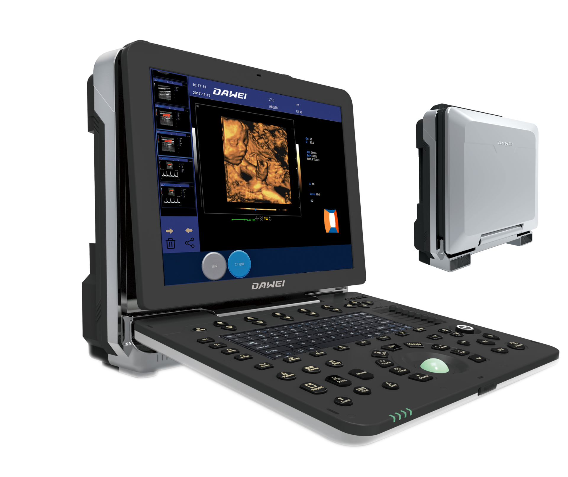 Dawei DW-P6 portable 4D color doppler ultrasound 