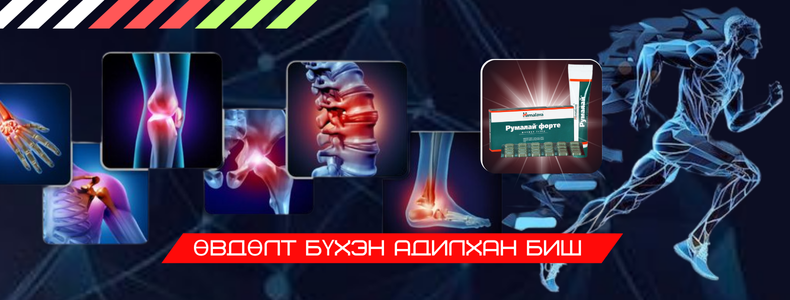 Өвдөлт бүхэн адилхан биш