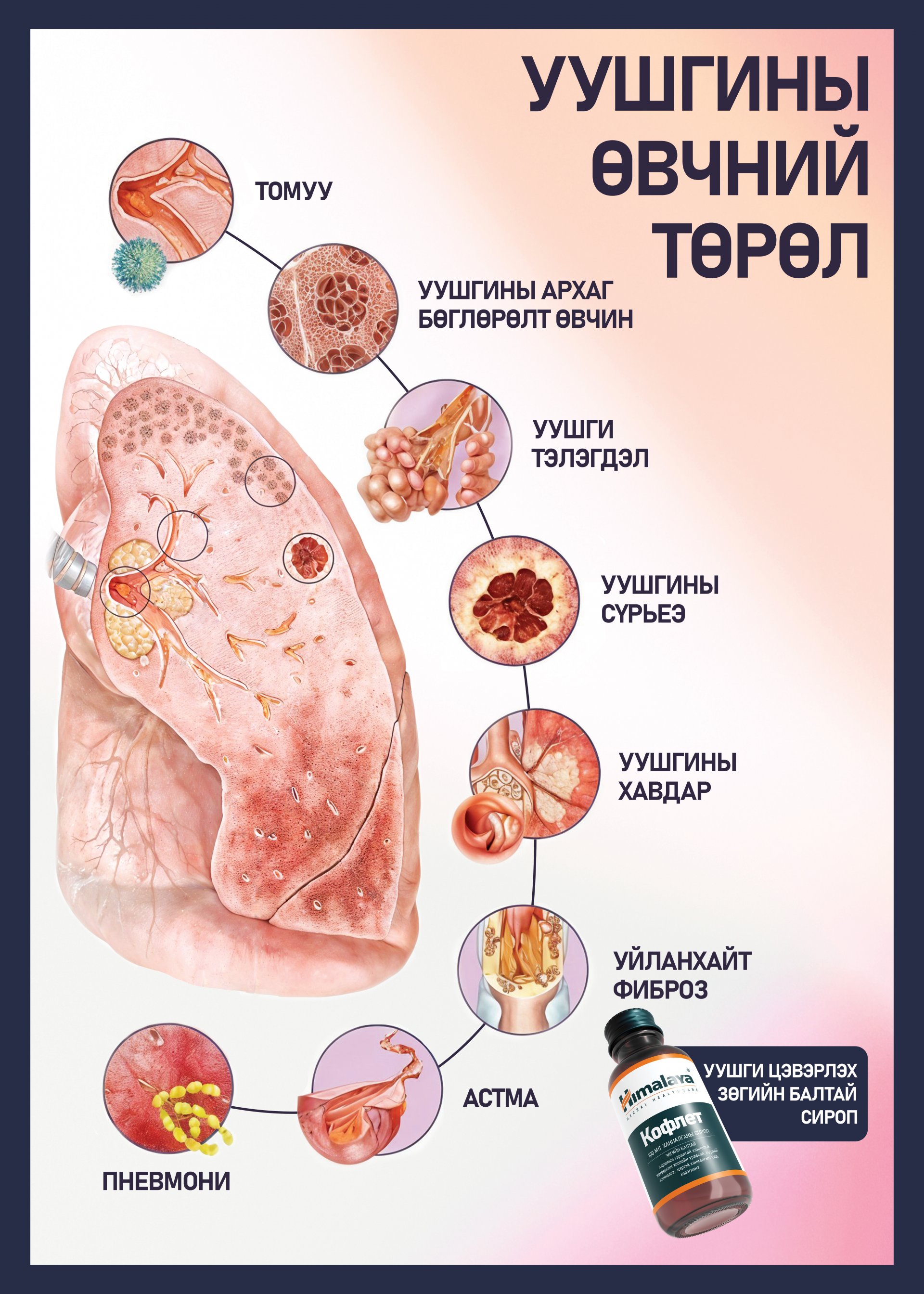 Таны уушгинд тусламж хэрэгтэй байгааг илтгэх 5 шинж 