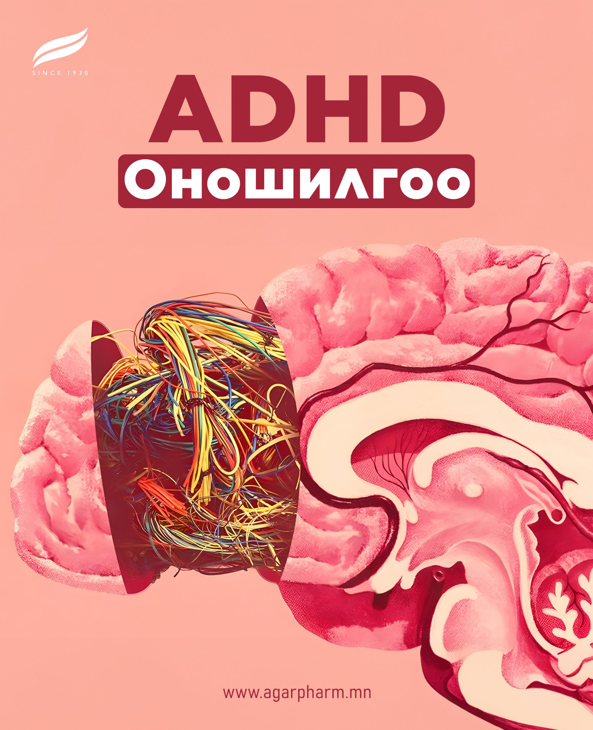 ADHD оношлох нь