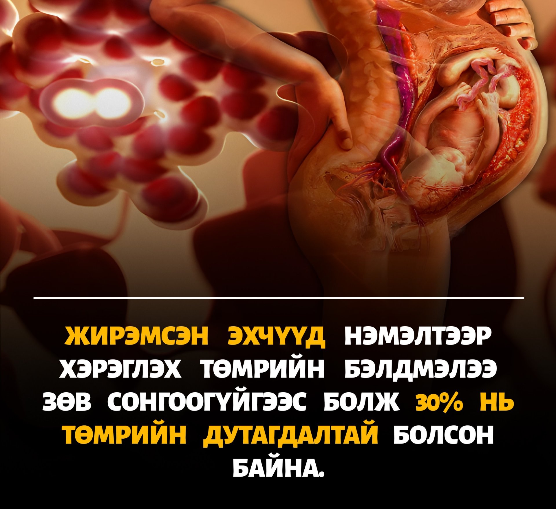 Жирэмсэн үедээ ямар төмөр сонгох вэ?