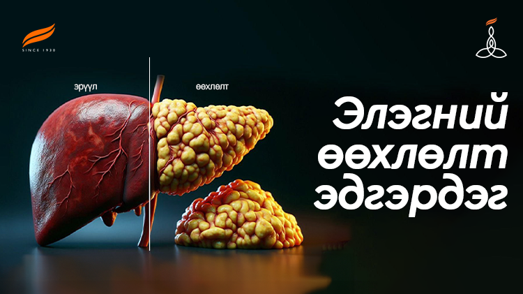 Элэгний өөхлөлт эдгэрдэг