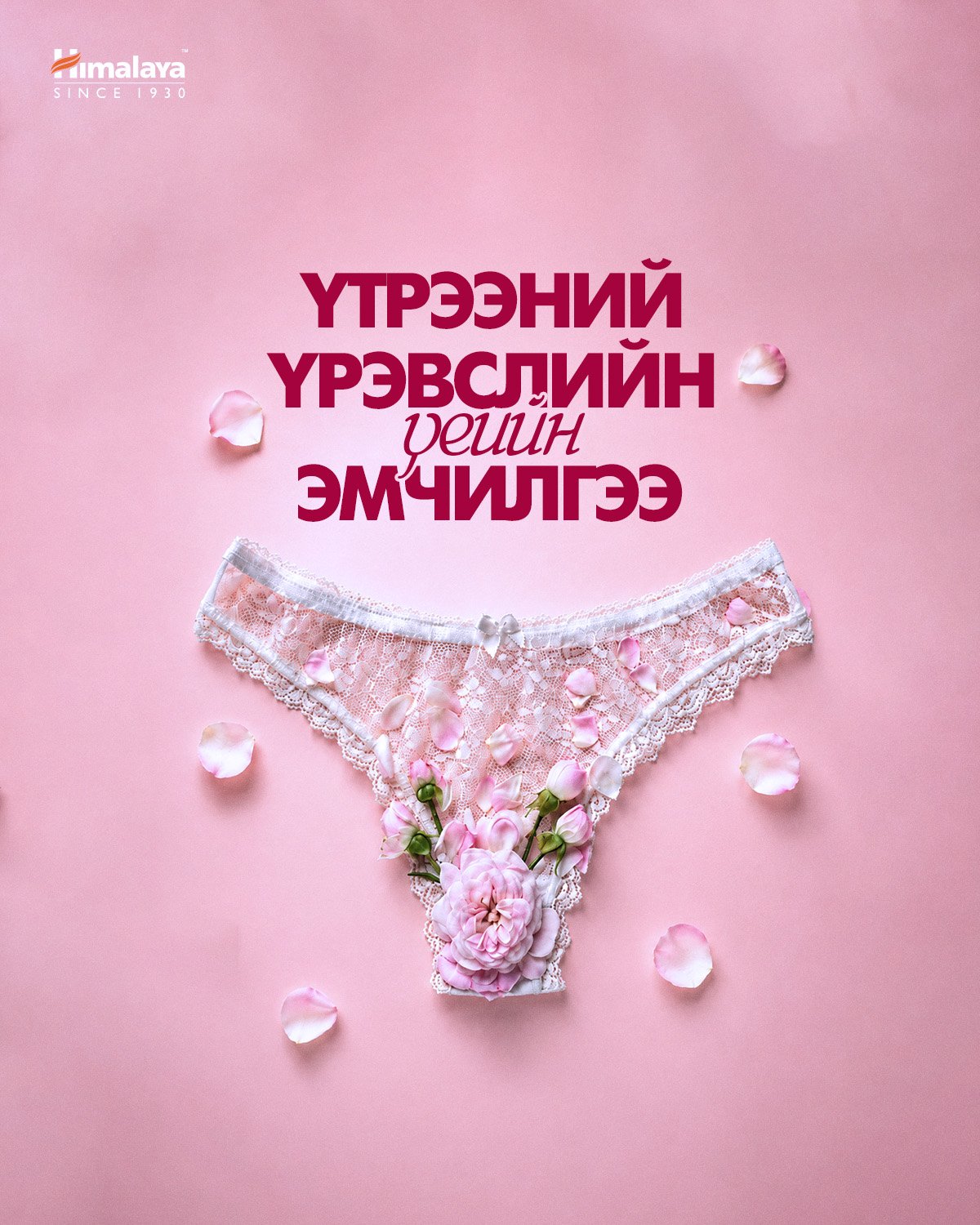 Үтрээний үрэвслийн үеийн эмчилгээ