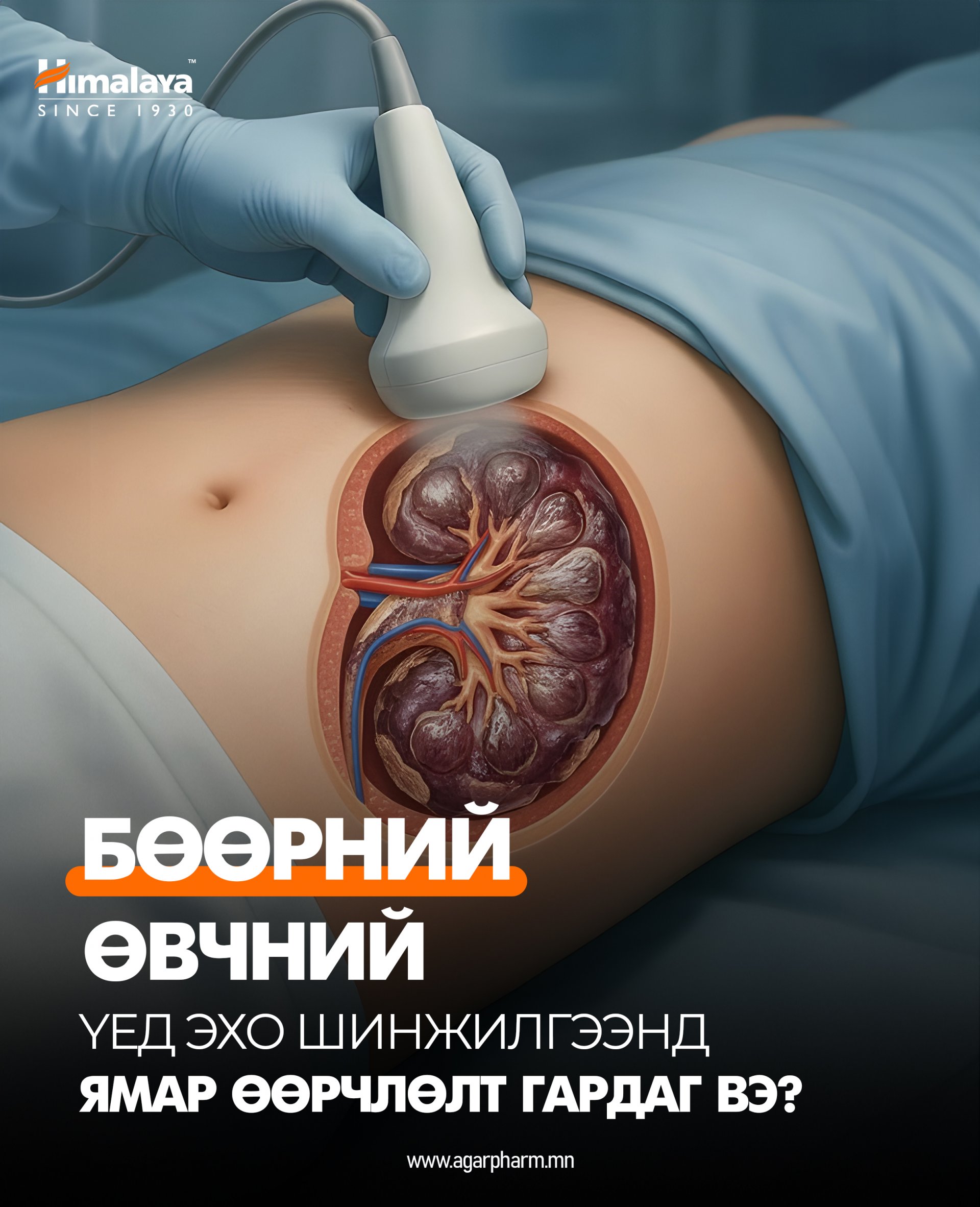 Бөөрний өвчнийг эхо шинжилгээгээр оношлох нь