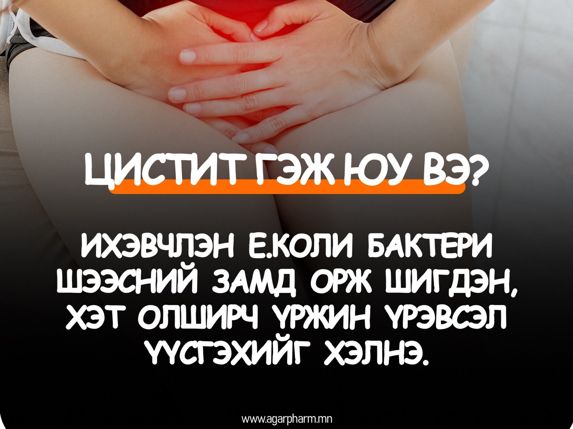 Цистит гэж юу вэ?