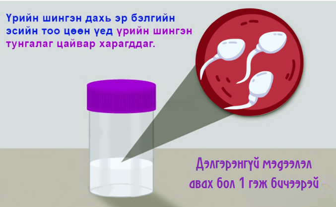 Бэлгийн замын өвчлөл нь үргүйдэлд хүргэдгийг та мэдэх үү?