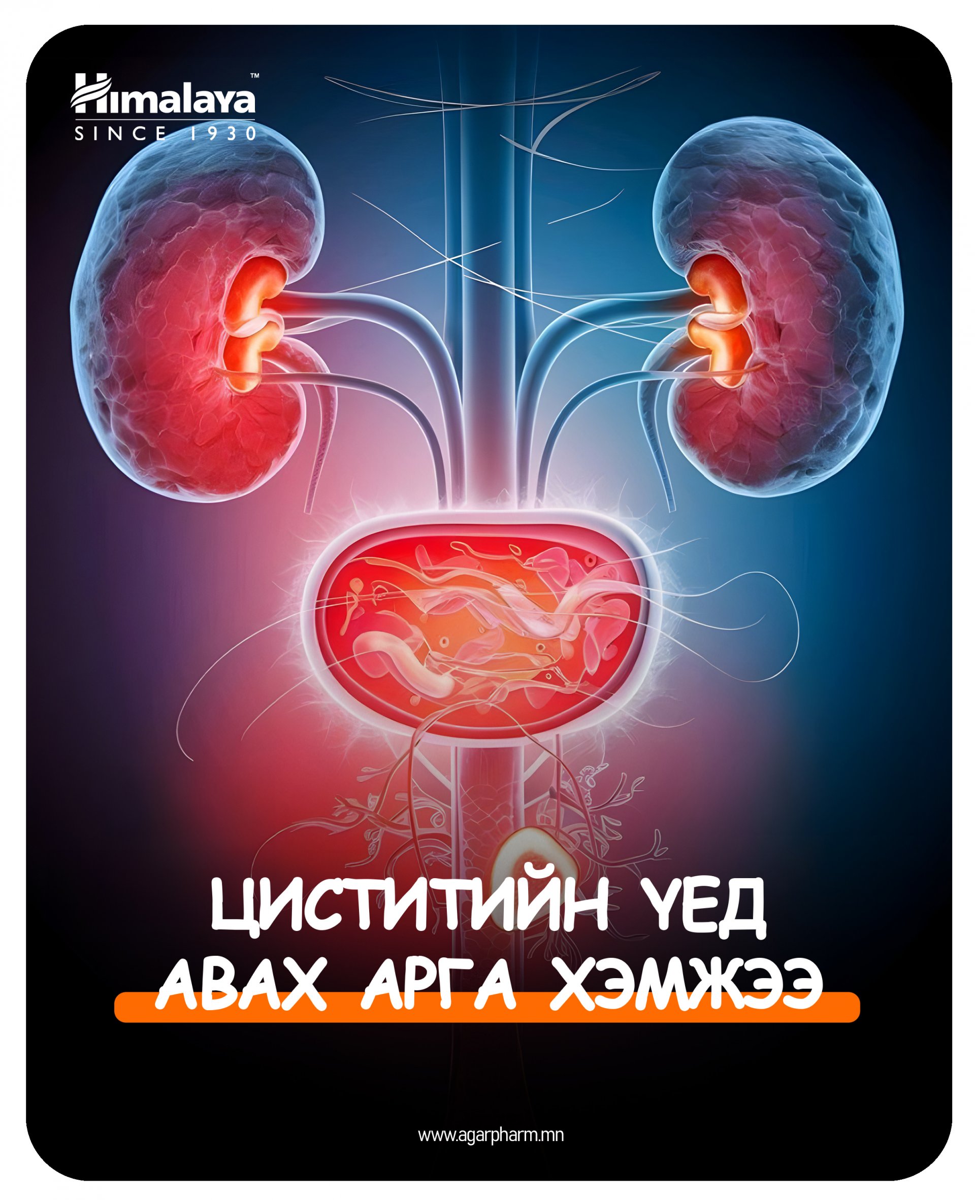 Хэрвээ та циститээр өвдсөн бол.....