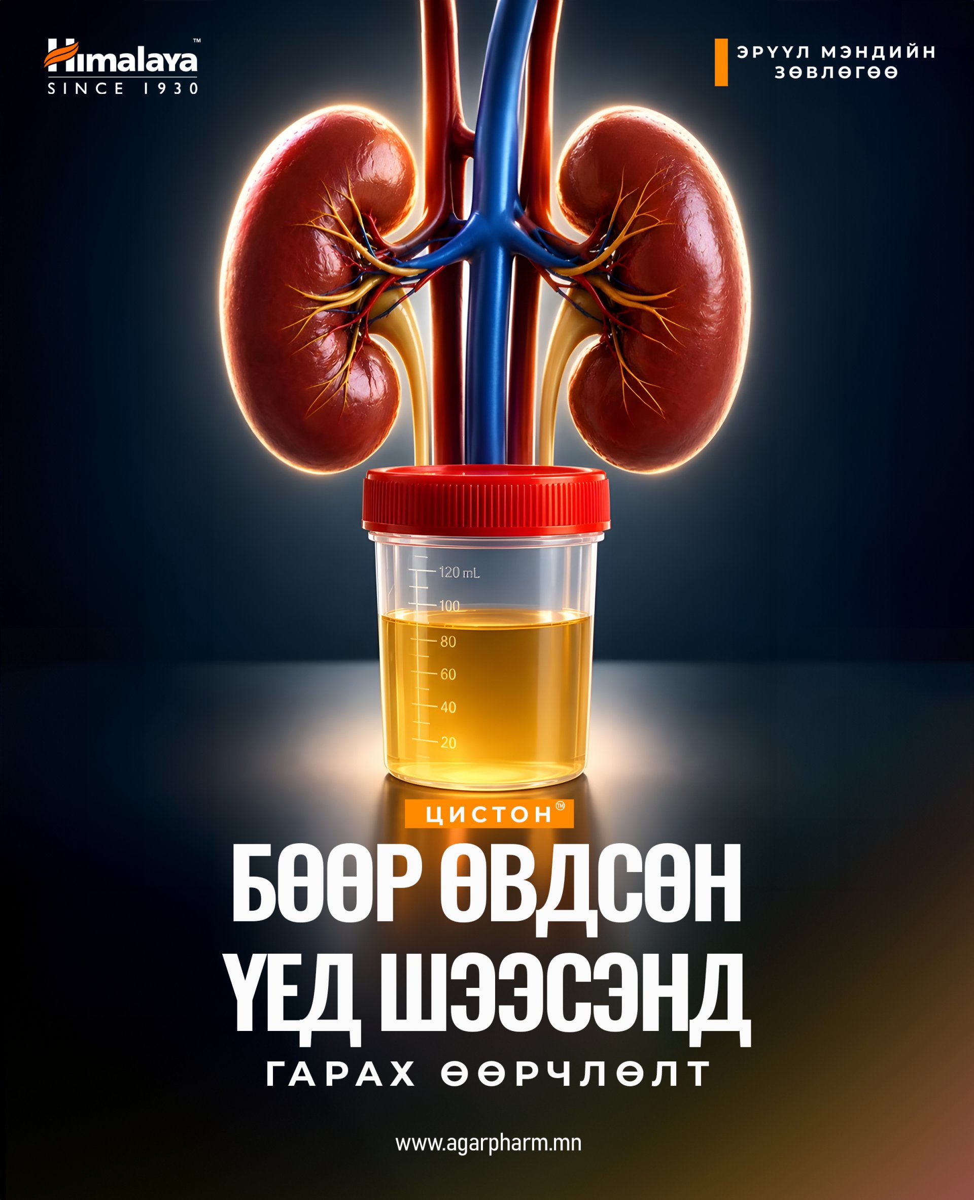 Бөөрний өвчний эхний дохио - ШЭЭСНИЙ ӨӨРЧЛӨЛТ