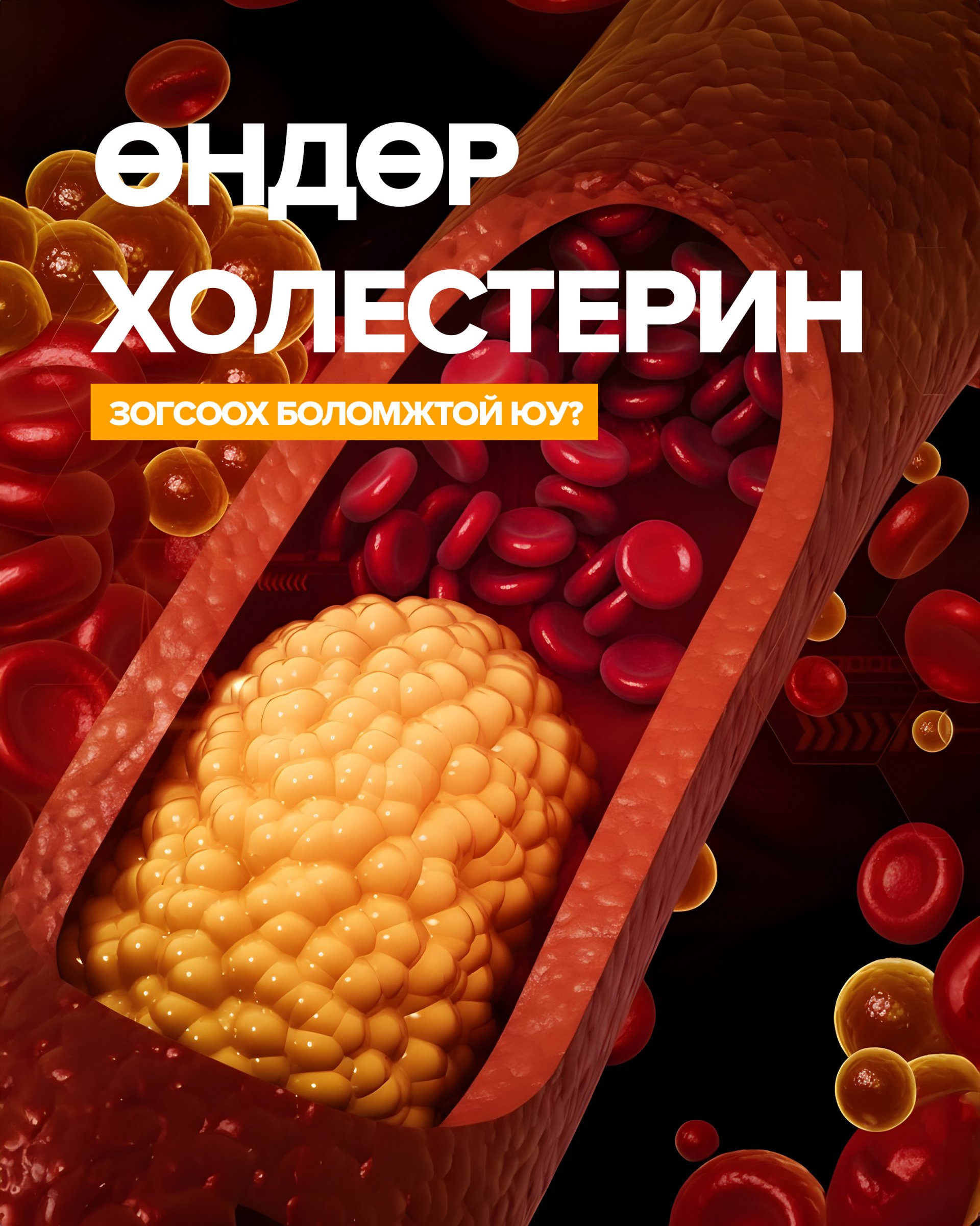 Зүрхний өвчлөлийн эрсдэлийг бууруулах шинэ боломж 