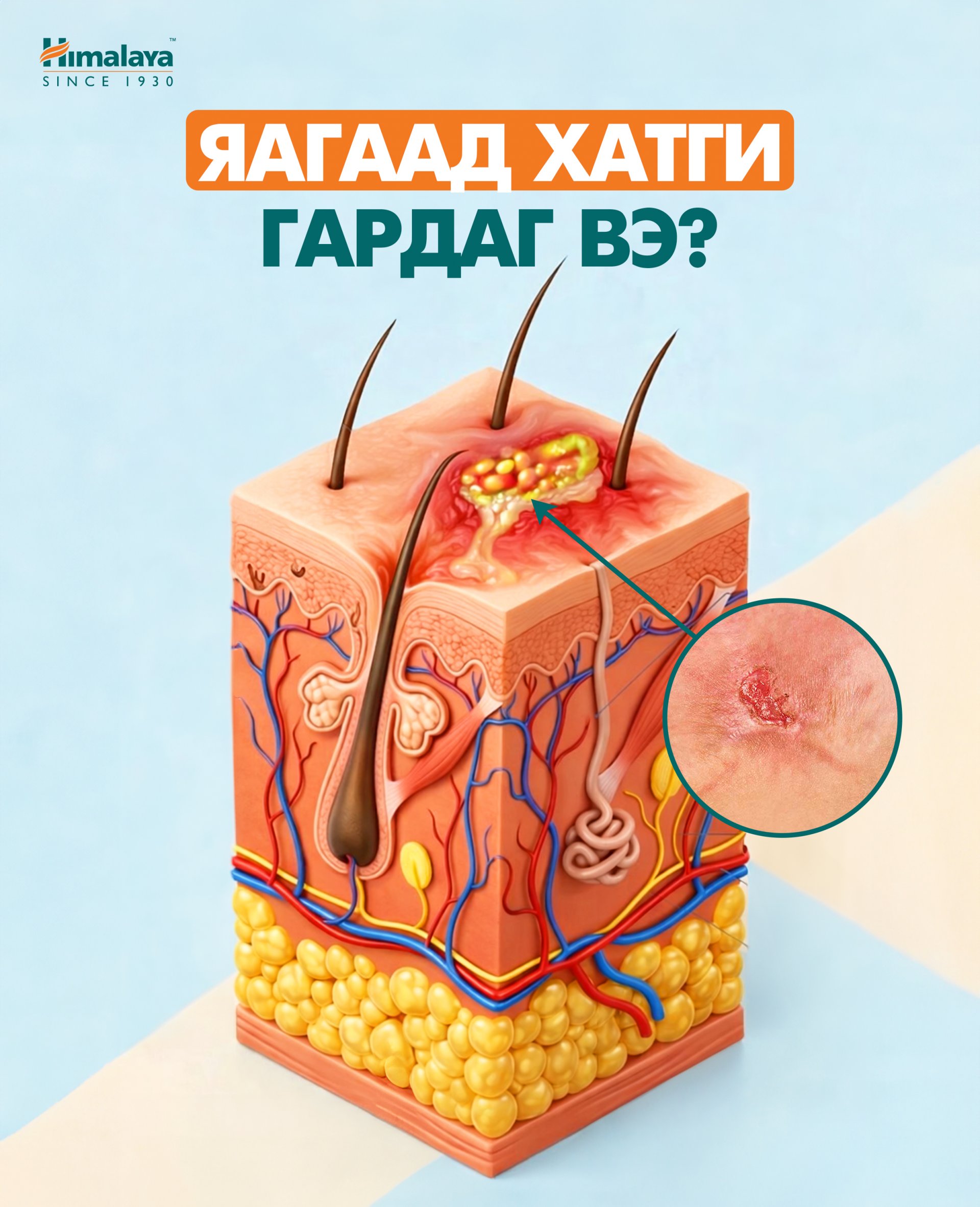Яагаад хатги гардаг вэ?