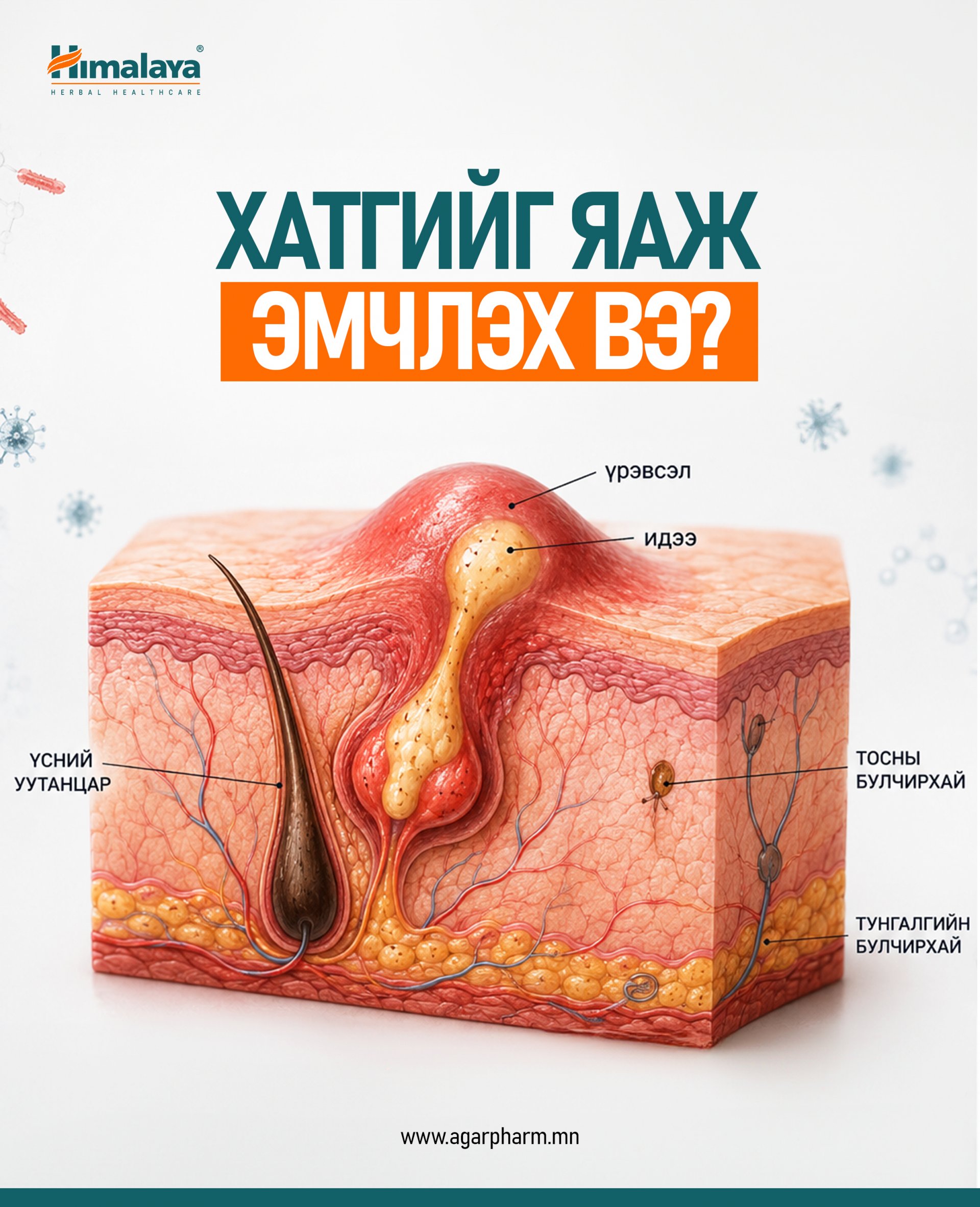 Хатгийг яаж эмчлэх вэ?