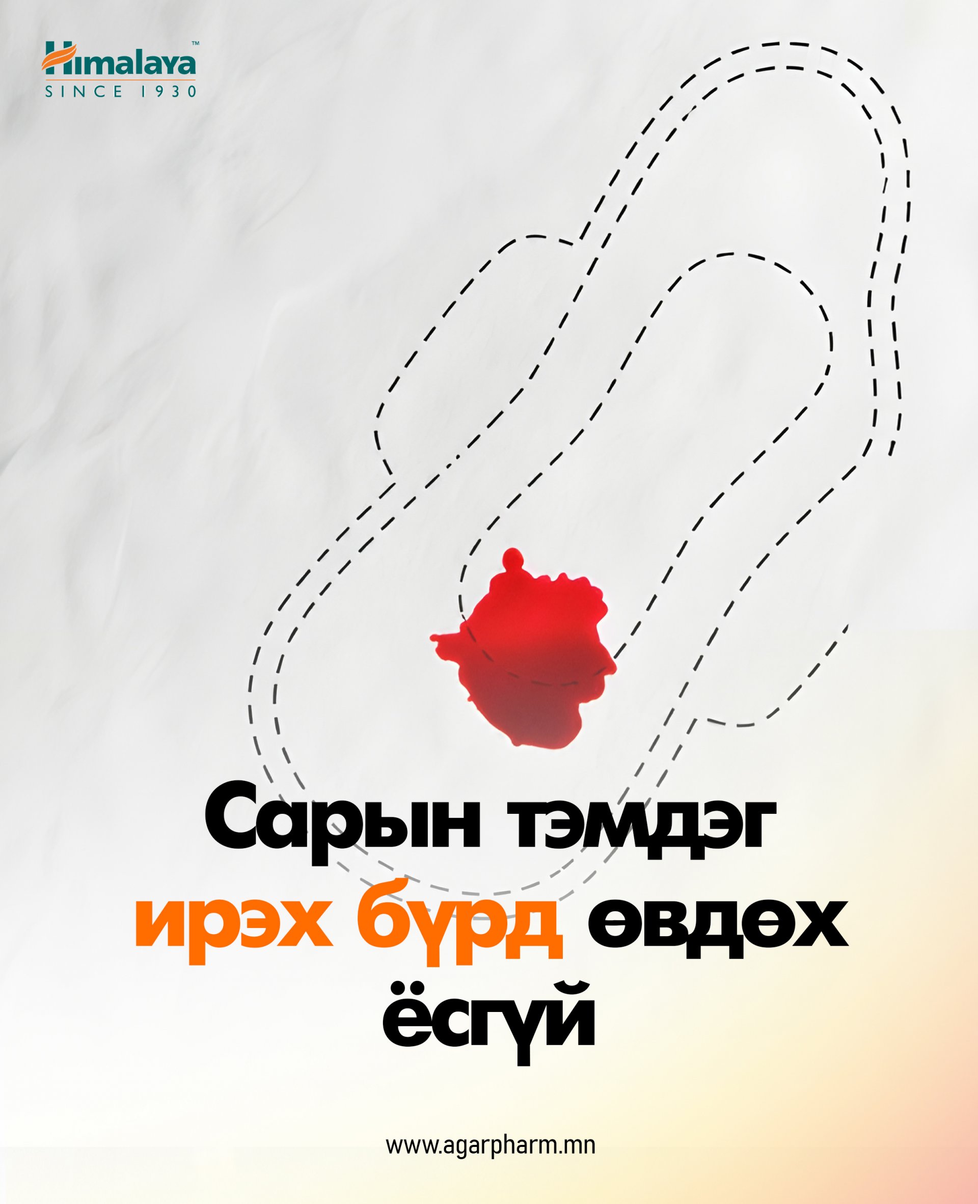 Сарын тэмдгийн өвдөлт намдаах аргууд