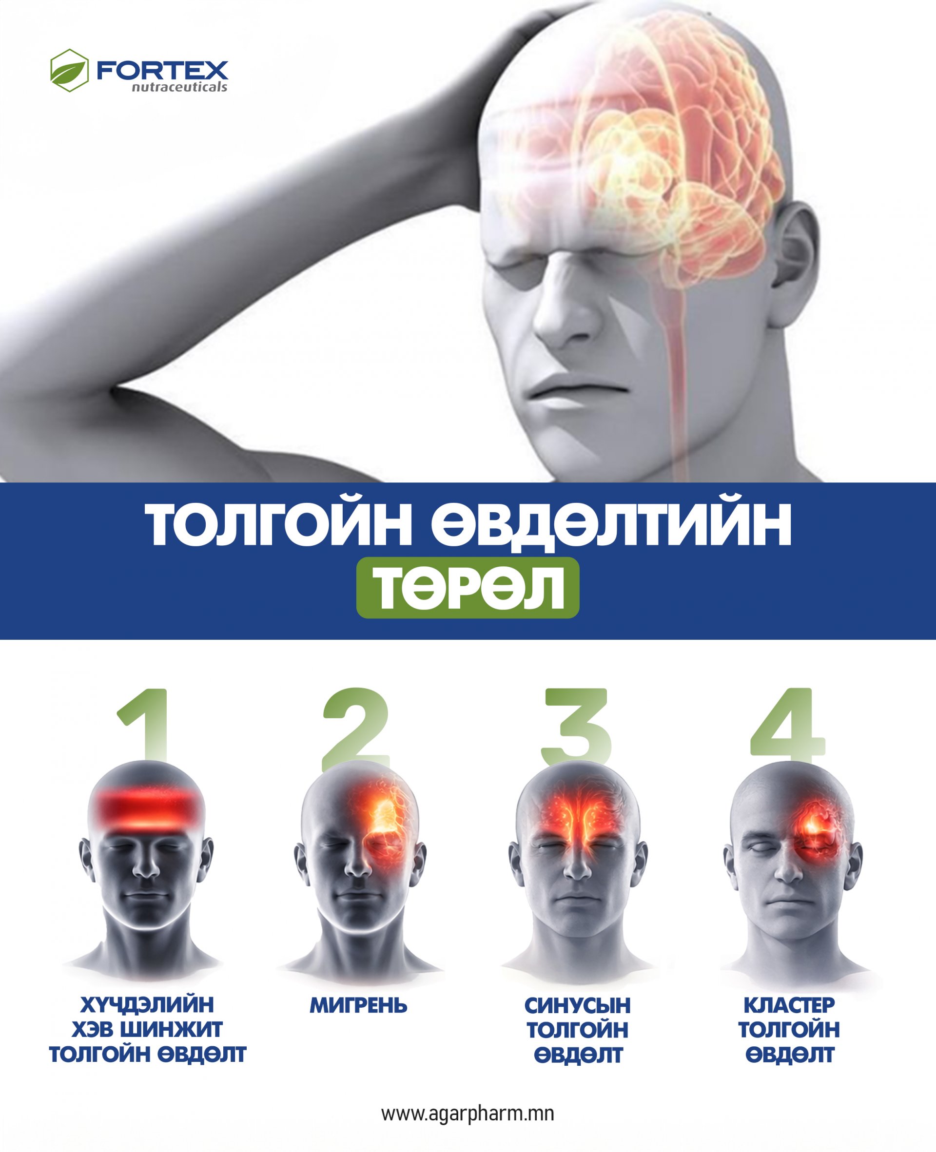 Толгойн өвдөлтийн төрлүүдийн ялгаа