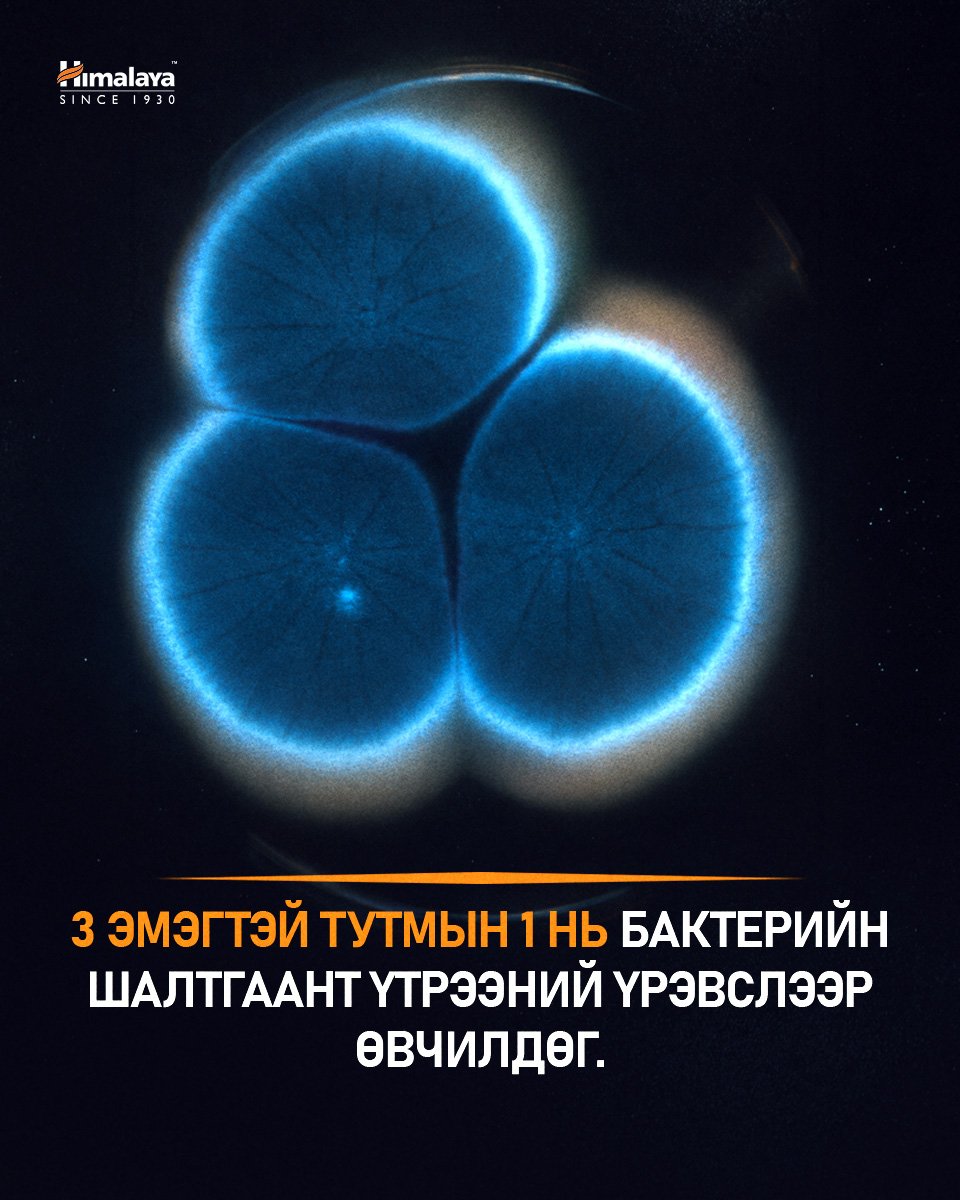 Үтрээний үрэвсэл: Шалтгаан ба шинж тэмдэг