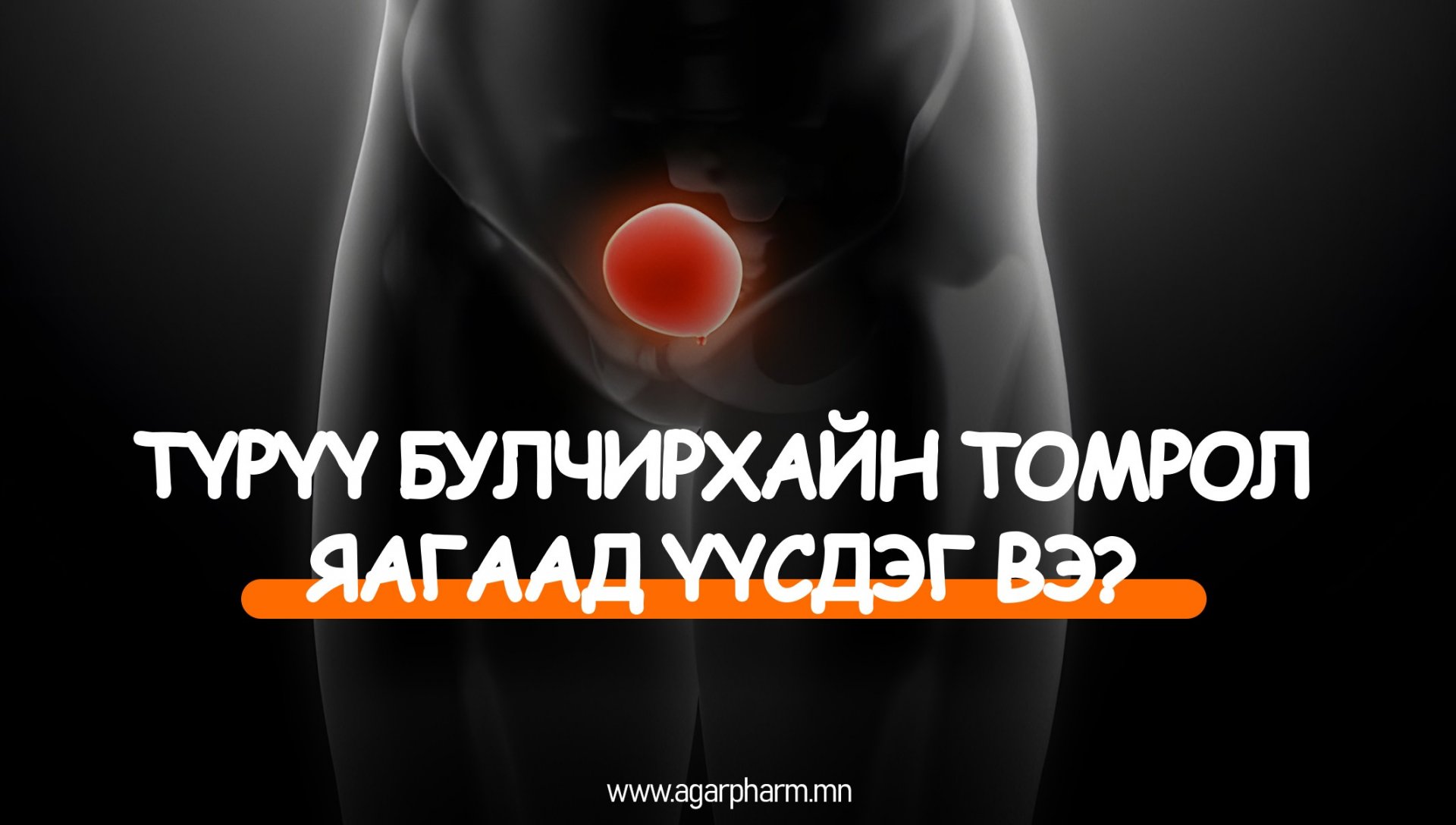 Түрүү булчирхайн томрол үүсэх шалтгаан