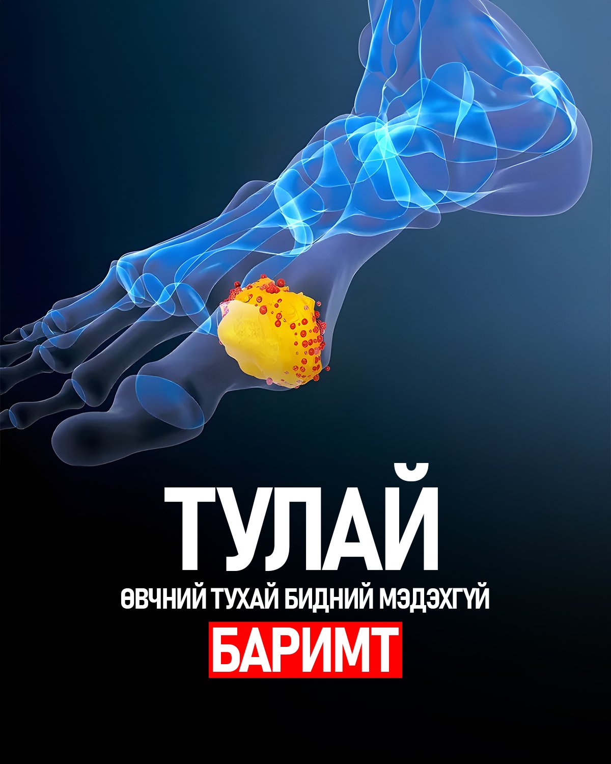Тулай өвчний тухай хүмүүсийн мэддэггүй баримтууд