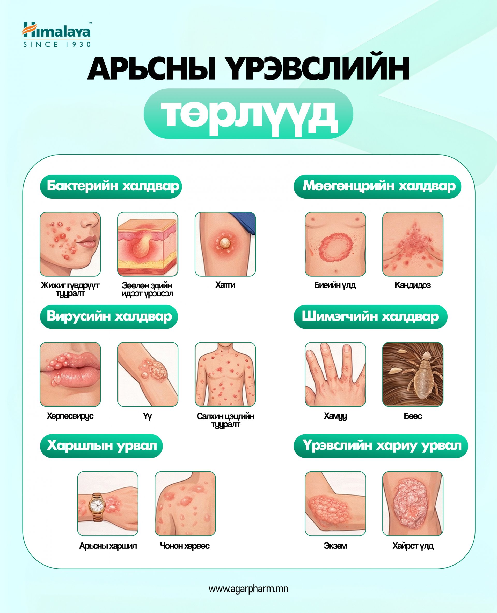 Арьсны үрэвслийн төрлүүд 